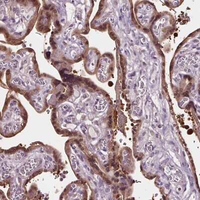 Immunohistochemistry-Paraffin: Ras-GAP Antibody [NBP2-56891]