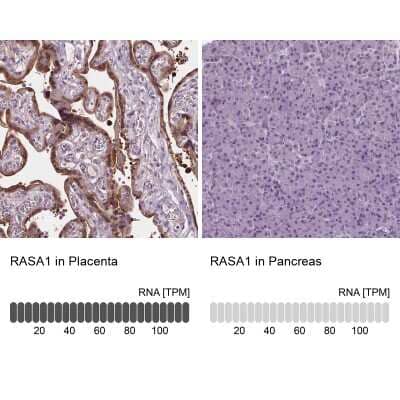 Immunohistochemistry-Paraffin: Ras-GAP Antibody [NBP2-56891]