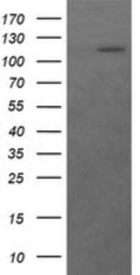 Western Blot: Ras-GAP Antibody (OTI1H2)Azide and BSA Free [NBP2-73804]