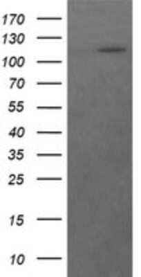 Western Blot: Ras-GAP Antibody (OTI1H2) [NBP2-45518]