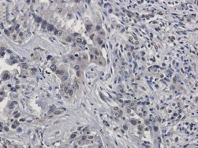 Immunohistochemistry-Paraffin: Ras-GAP Antibody (S01-1D7) [NBP3-20000]