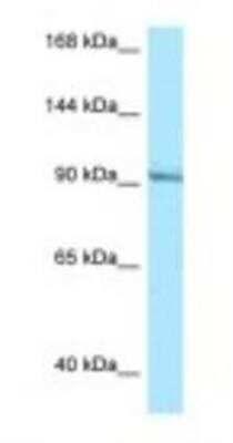 Western Blot: Rasgrp1 Antibody [NBP1-98413]