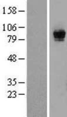 Western Blot: Rasgrp1 Overexpression Lysate [NBP2-07713]