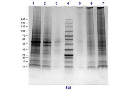 SDS-PAGE: Rat Brain Whole Tissue Lysate (Post-Natal Whole) [NBP3-05287]