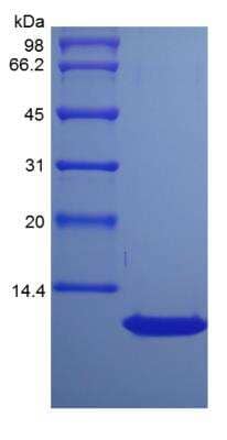 SDS-PAGE: Recombinant Rat CCL17/TARC Protein [NBP2-35298]