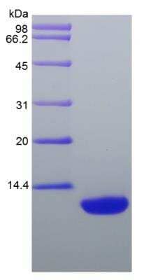 SDS-PAGE: Recombinant Rat CCL22/MDC Protein [NBP2-35269]