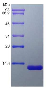 SDS-PAGE: Recombinant Rat CCL24/Eotaxin-2/MPIF-2 Protein [NBP2-35295]