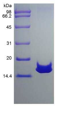 SDS-PAGE: Recombinant Rat CCL28 Protein [NBP2-35271]