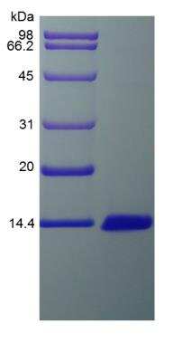 SDS-PAGE: Recombinant Rat CCL7/MCP-3/MARC Protein [NBP2-35267]