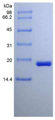 SDS-PAGE: Recombinant Rat CDNF Protein [NBP2-35246]