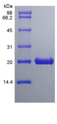 SDS-PAGE: Recombinant Rat CNTF Protein [NBP2-35289]