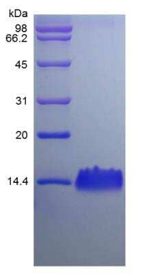 SDS-PAGE: Recombinant Rat CXCL5/ENA-78 Protein [NBP2-35266]