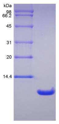 SDS-PAGE: Recombinant Rat CXCL7/NAP-2 Protein [NBP2-35279]