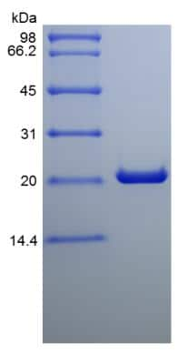 SDS-PAGE: Recombinant Rat Cardiotrophin-1/CT-1 Protein [NBP2-35292]