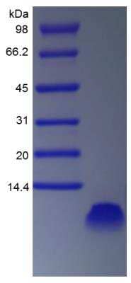 SDS-PAGE: Recombinant Rat EGF Protein [NBP2-35293]