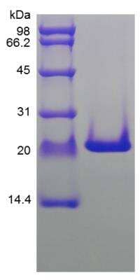 SDS-PAGE: Recombinant Rat FGF-10 Protein [NBP2-35261]