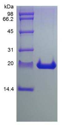 SDS-PAGE: Recombinant Rat FGF-21 Protein [NBP2-35194]