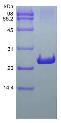 SDS-PAGE: Recombinant Rat FGF-9 Protein [NBP2-35196]