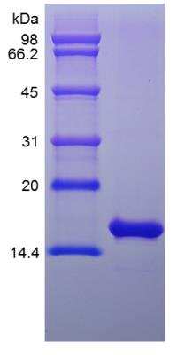 SDS-PAGE: Recombinant Rat FGF basic/FGF2/bFGF Protein [NBP2-35239]