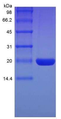 SDS-PAGE: Recombinant Rat G-CSF Protein [NBP2-35201]