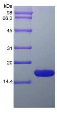 SDS-PAGE: Recombinant Rat GMF-beta Protein [NBP2-35207]