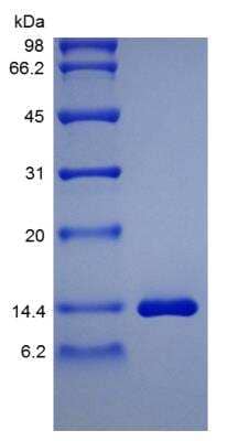 SDS-PAGE: Recombinant Rat HB-EGF Protein [NBP2-35210]