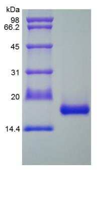 SDS-PAGE: Recombinant Rat IL-1ra/IL-1F3/IL1RN Protein [NBP2-35225]