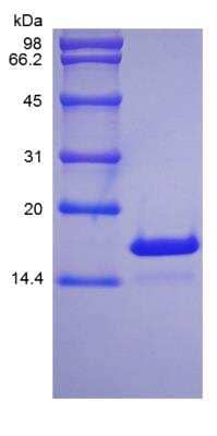 SDS-PAGE: Recombinant Rat IL-21 Protein [NBP2-35241]