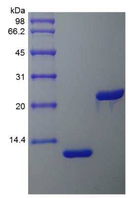 SDS-PAGE: Recombinant Rat IL-5 Protein [NBP2-35253]