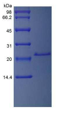 SDS-PAGE: Recombinant Rat IL-6 Protein [NBP2-35254]