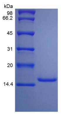 SDS-PAGE: Recombinant Rat IL-9 Protein [NBP2-35257]