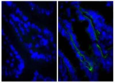 Immunofluorescence: Rat IgG2a Isotype Control (KLH/G2a-1-1) [NBP1-51104]