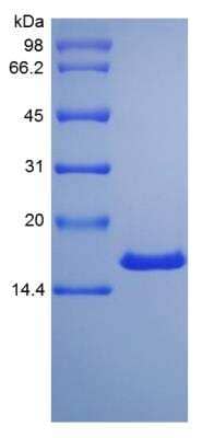 SDS-PAGE: Recombinant Rat Midkine Protein [NBP2-35273]