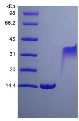 SDS-PAGE: Recombinant Rat PDGF-BB Protein [NBP2-35285]