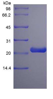 SDS-PAGE: Recombinant Rat Prolactin Protein [NBP2-35287]