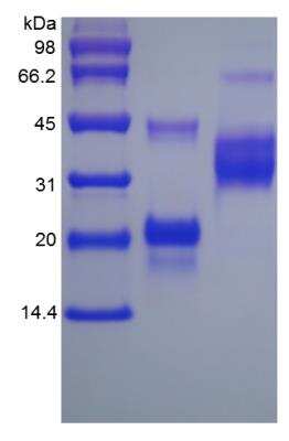 SDS-PAGE: Recombinant Rat VEGF 164 Protein [NBP2-35310]