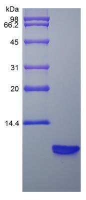 SDS-PAGE: Recombinant Rat beta-Defensin 3 Protein [NBP2-35237]