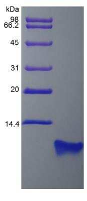 SDS-PAGE: Recombinant Rat beta-Defensin 4/2 Protein [NBP2-35238]