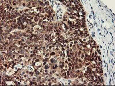 Immunohistochemistry: RbAp46 Antibody (OTI5A4) - Azide and BSA Free [NBP2-73822]
