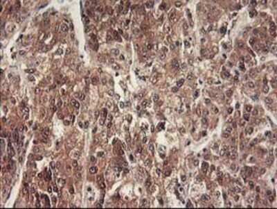 Immunohistochemistry: RbAp46 Antibody (OTI5A4) - Azide and BSA Free [NBP2-73822]