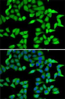 Immunocytochemistry/ Immunofluorescence: RbBP5 Antibody - BSA Free [NBP2-95234]