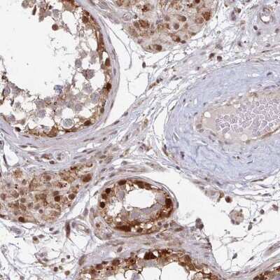Immunohistochemistry-Paraffin: RbBP5 Antibody [NBP2-34100]