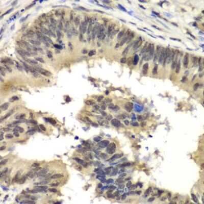 Immunohistochemistry-Paraffin: RbBP5 Antibody - BSA Free [NBP2-95234]