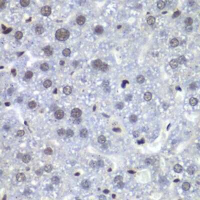 Immunohistochemistry-Paraffin: RbBP5 Antibody - BSA Free [NBP2-95234]