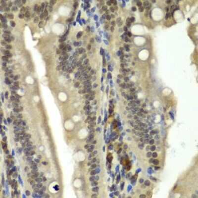 Immunohistochemistry-Paraffin: RbBP5 Antibody - BSA Free [NBP2-95234]