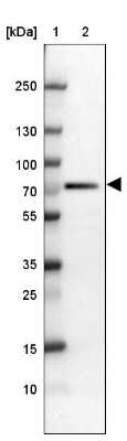 Western Blot: RbBP5 Antibody [NBP2-34100]