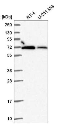 Western Blot: RbBP5 Antibody [NBP2-55085]