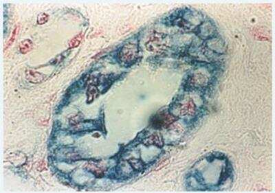 Immunohistochemistry-Paraffin: Real Blue Peroxidase Substrate Kit [KA0565]