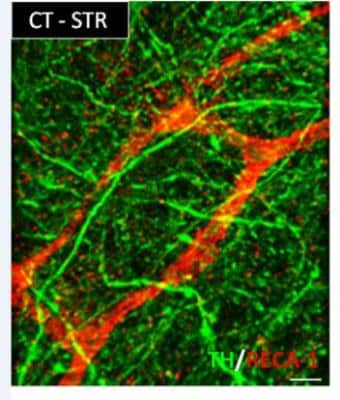 Immunohistochemistry-Frozen: RecA-1 Antibody (HIS52) - BSA Free [NB100-64647]