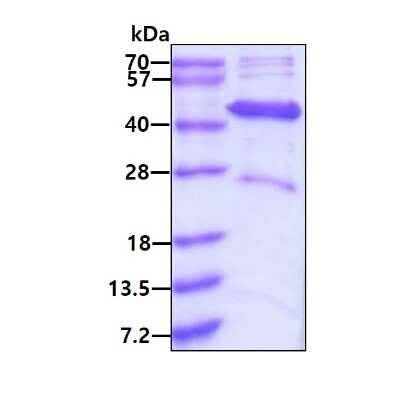 SDS-PAGE: Recombinant Human ACADL His Protein [NBP1-72517]